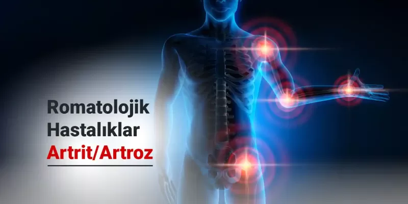 Romatolojik Hastalıklar - Artrit / Artroz