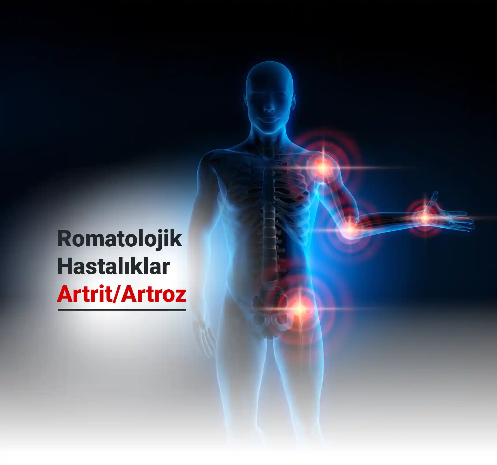 Romatolojik Hastalıklar - Artrit / Artroz