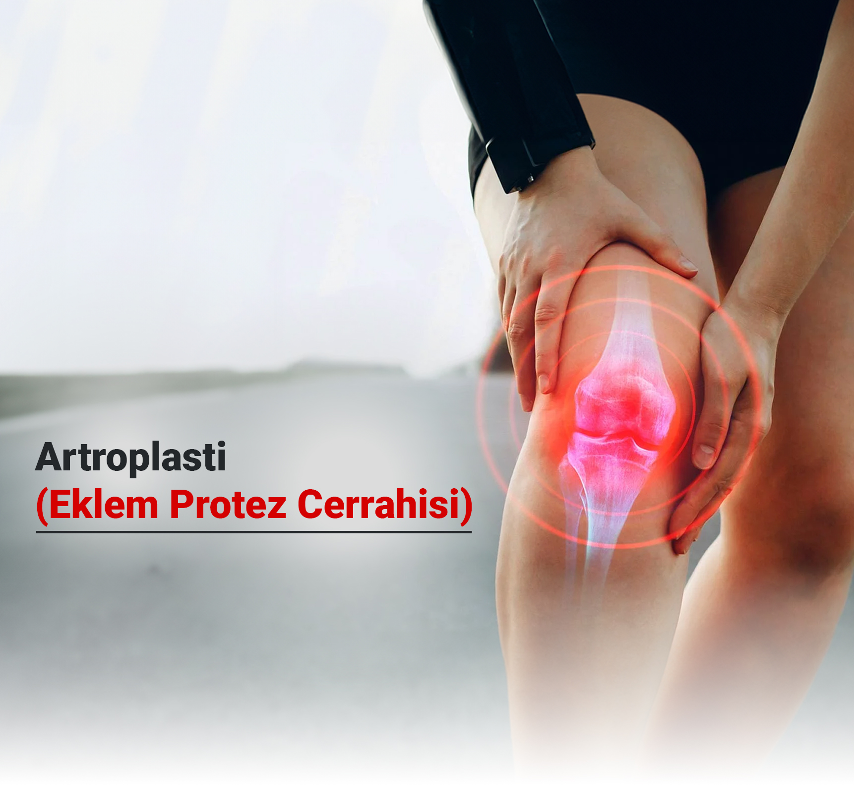 Artroplasti (Eklem Protez Cerrahisi) Nedir? Hangi Durumlarda Uygulanır?