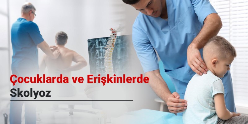 Skolyoz Nedir? Çocuklarda ve Erişkinlerde Skolyoz