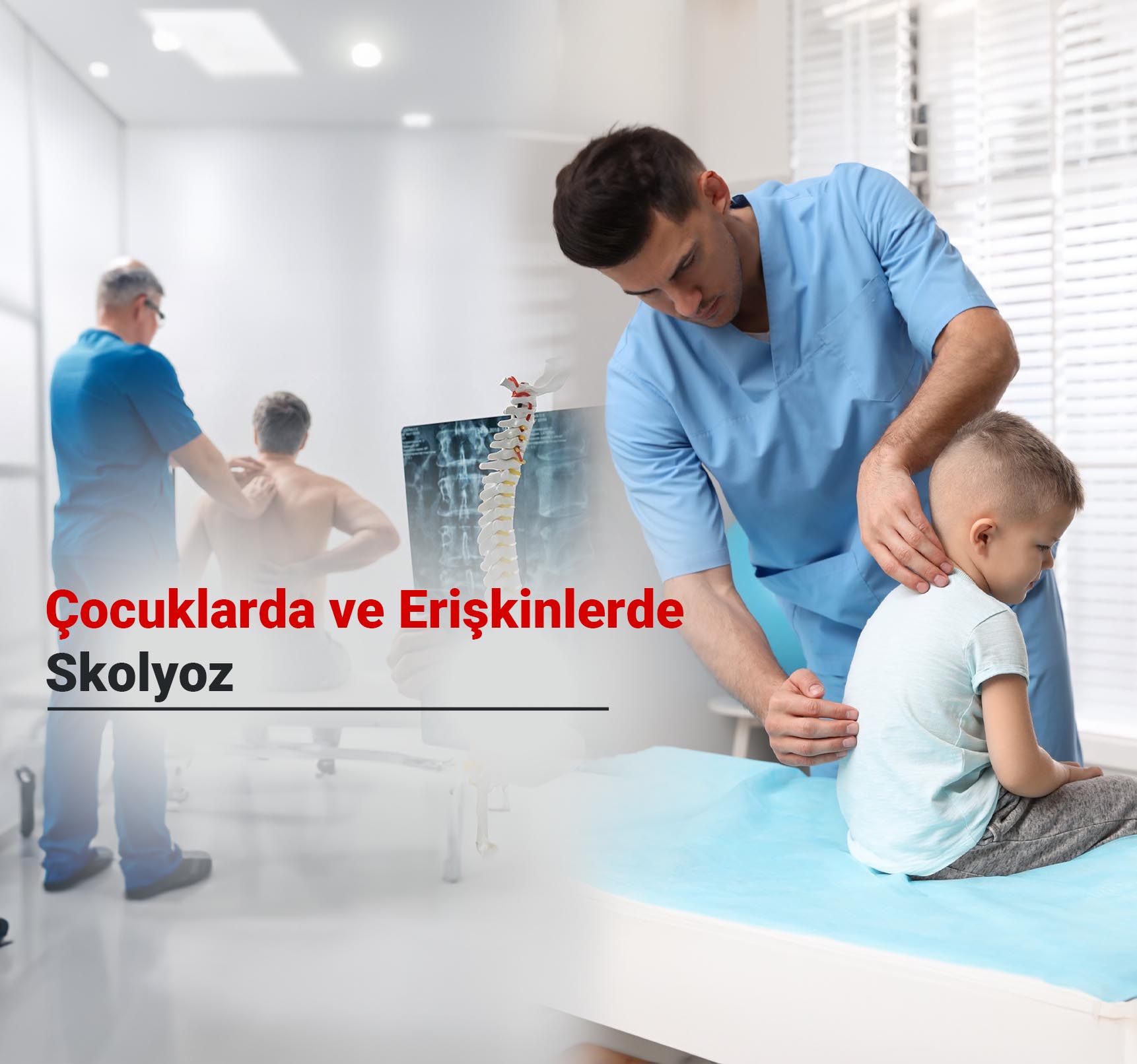 Skolyoz Nedir? Çocuklarda ve Erişkinlerde Skolyoz