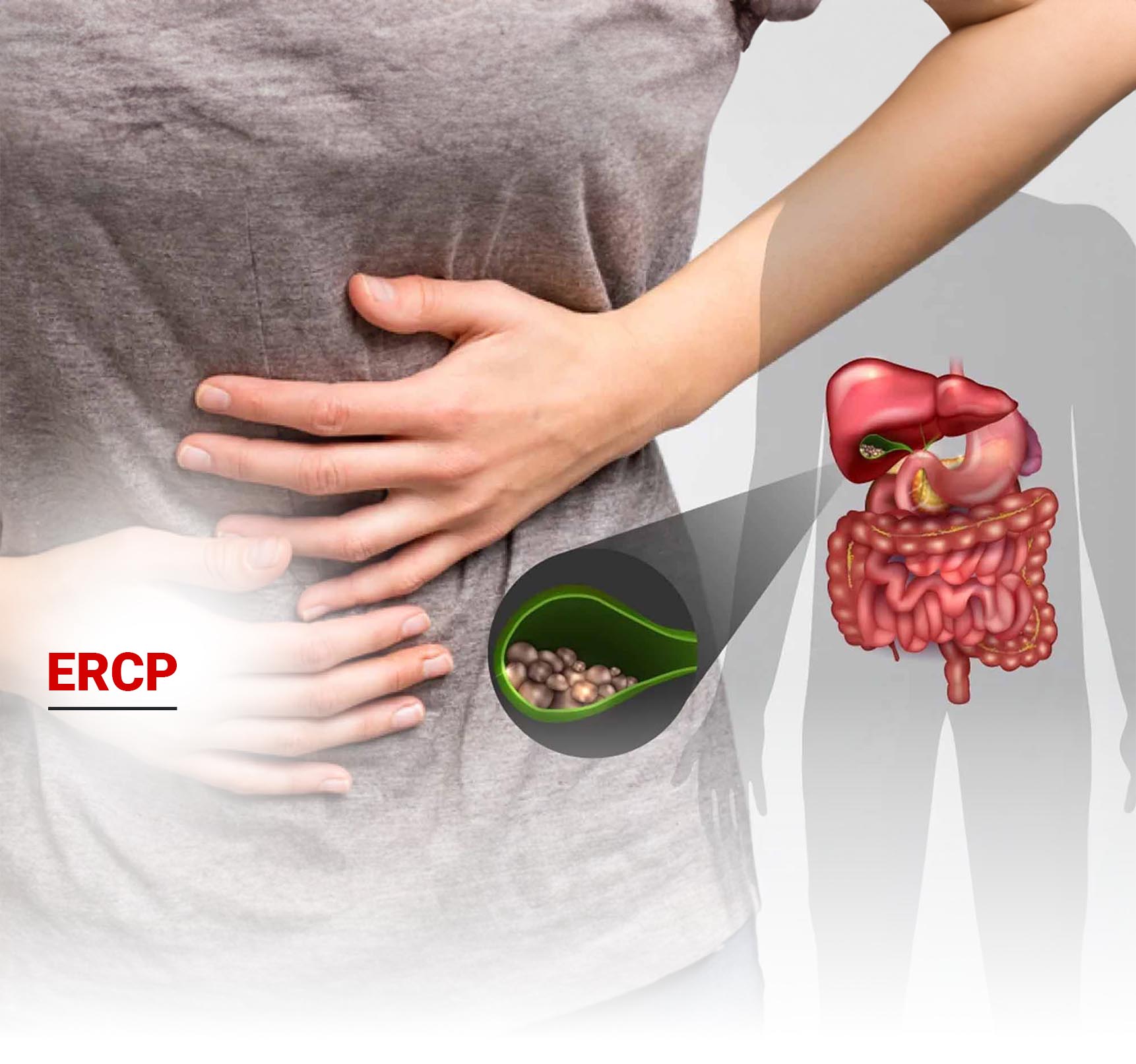 ERCP Nedir? Nasıl Yapılır? 