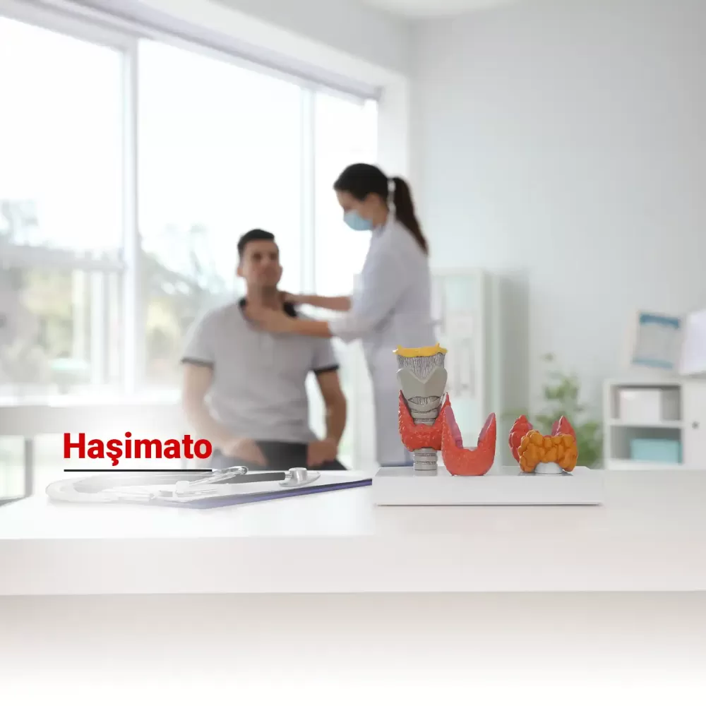 Haşimato Hastalığı Nedir? Tanısı Nasıl Konulur? Tedavisi Nasıldır?