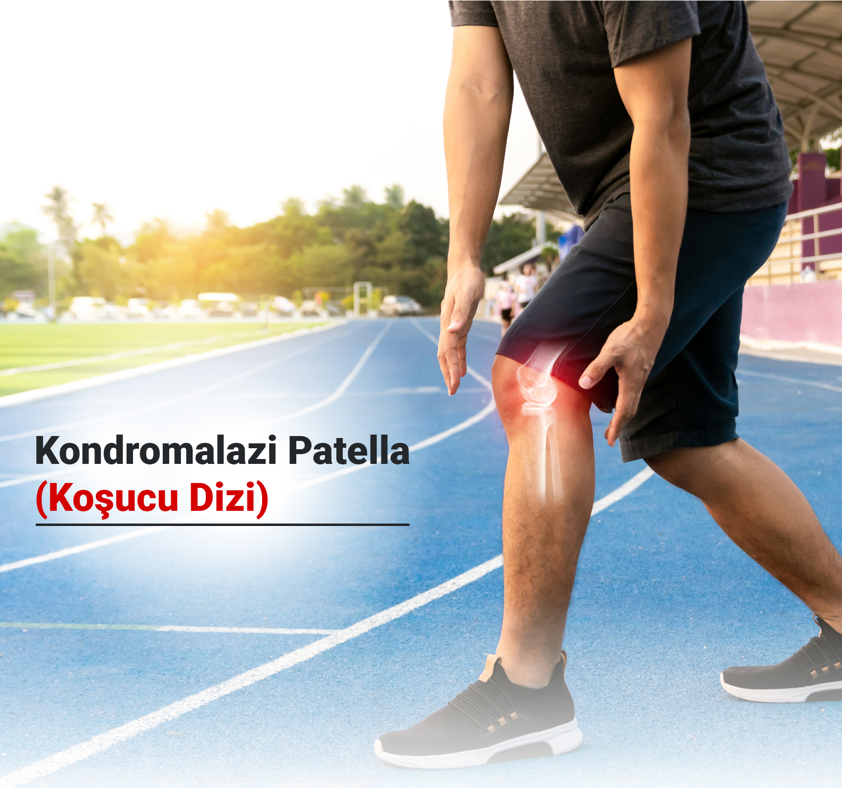 Kondromalazi Patella (Koşucu Dizi) Nedir? Belirtileri, Nedenleri ve Tedavi Yöntemleri