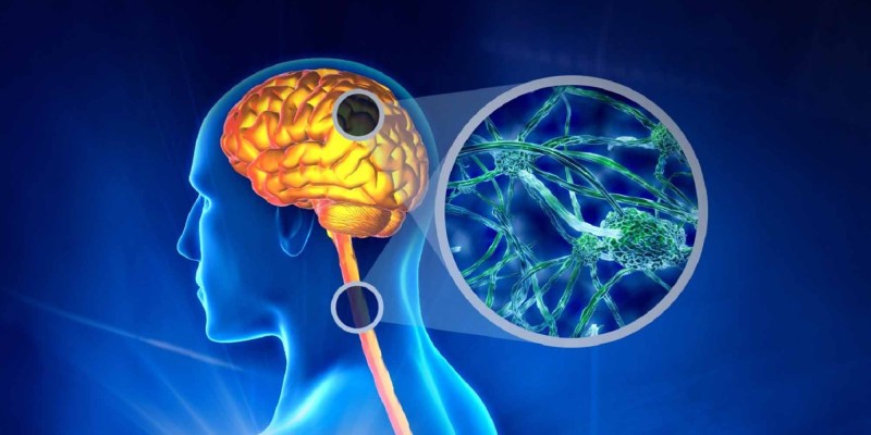 Merkezi Sinir Sistemini Etkileyen Hastalık: Multiple Skleroz (MS)