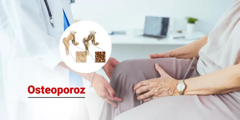 Osteoporoz Nedir? Tanı ve Tedavi Yöntemleri Nelerdir?