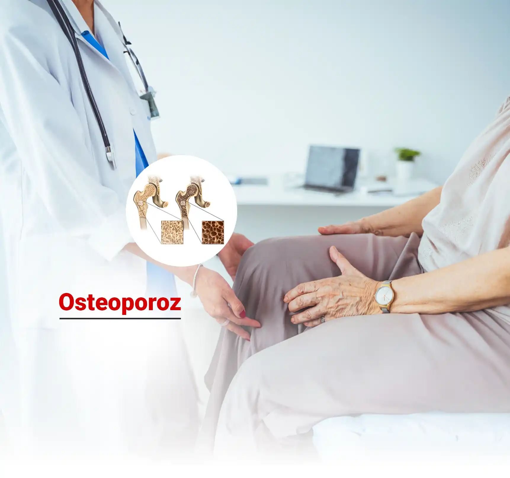 Osteoporoz Nedir? Tanı ve Tedavi Yöntemleri Nelerdir?