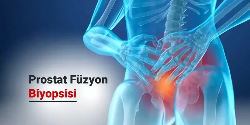 Prostat Füzyon Biyopsisi Nedir? Nasıl Yapılır?