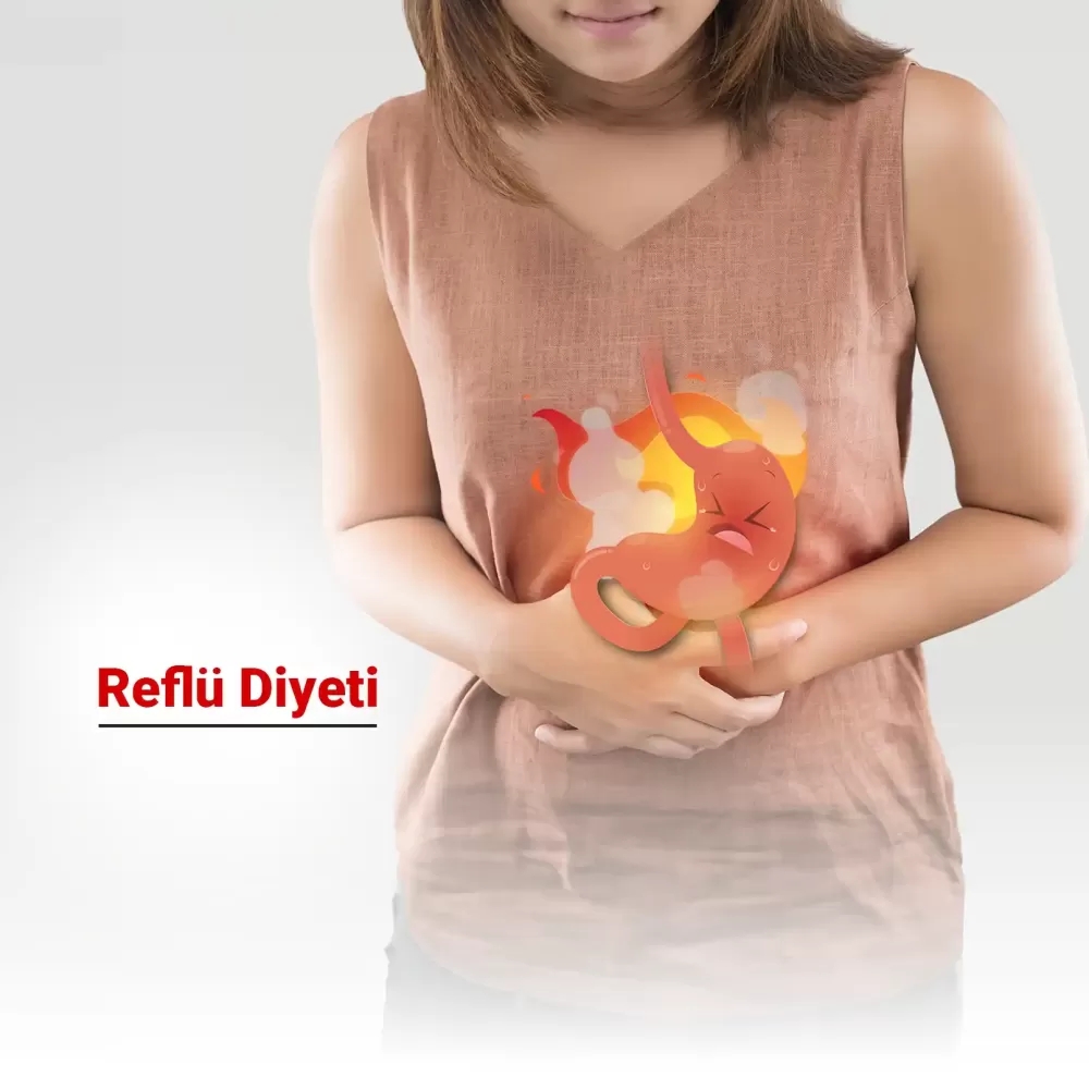 Reflü Diyeti Nedir? Reflüye İyi Gelen Beslenme Alışkanlıkları Nelerdir?