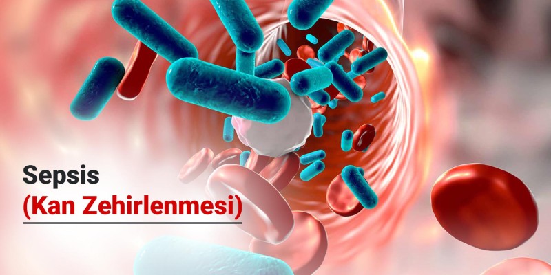 Sepsis (Kan Zehirlenmesi) Nedir?