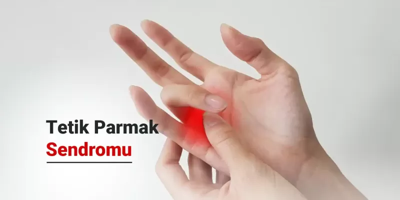 Tetik Parmak Sendromu Nedir? Nasıl Tedavi Edilir?